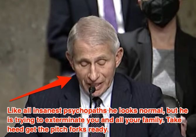 Fauci has lost his freaking mind
